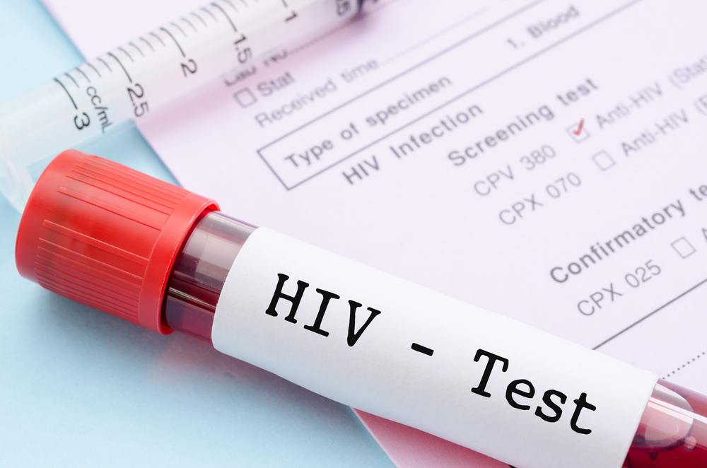 kuidas HIV-i edasi anda