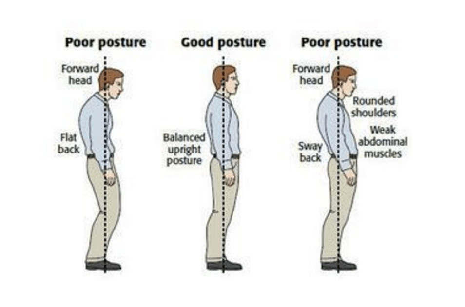 Pildiallikas: http://www.thephysiocompany.com/blog/stop-slouching-postural-dysfunction-symptoms-causes-and-treatment-of-bad-posture