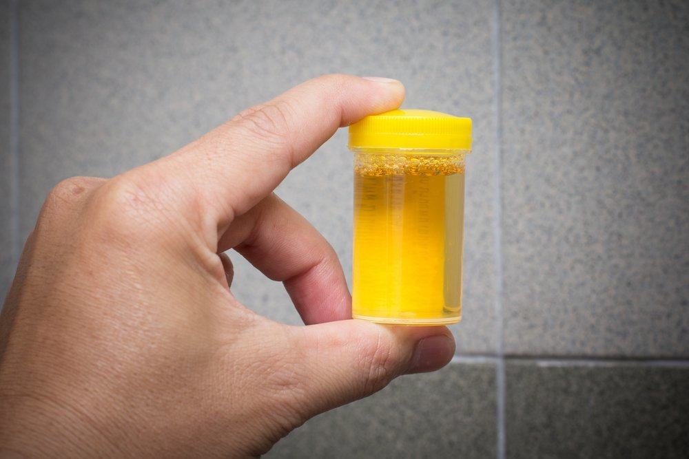 uriini ravi uriini tarvitamiseks