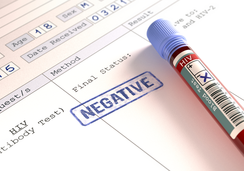 HIV-testi negatiivsete tulemuste tähendus