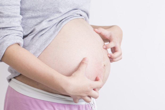 Kõhukaudne follikuliit on raseduse ajal sügeleva naha põhjuseks